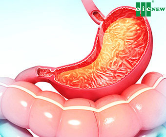 upload/files/DA_DAY/gastritis-s1-facts.jpg